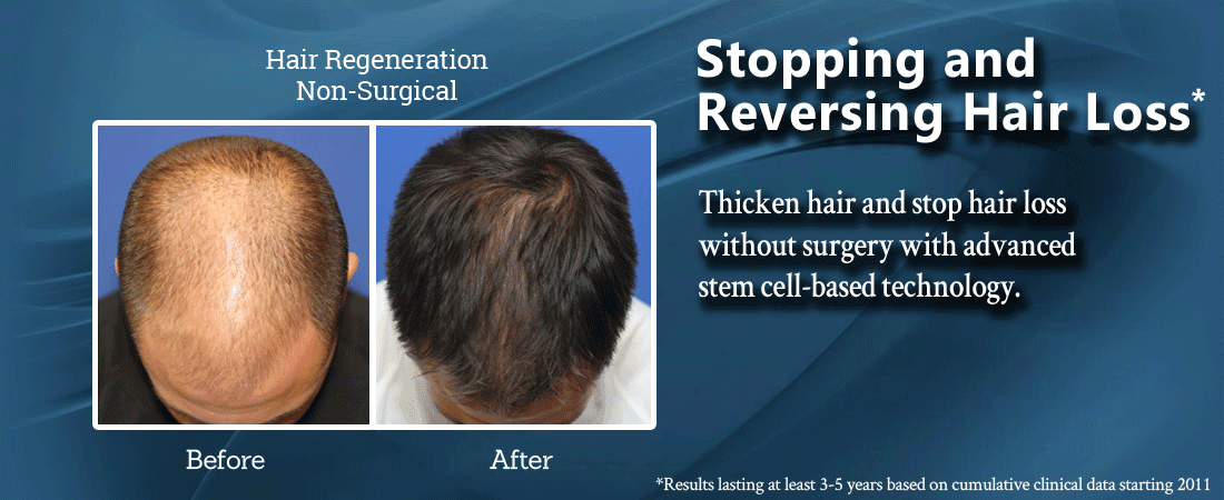 Non-surgical hair regeneration