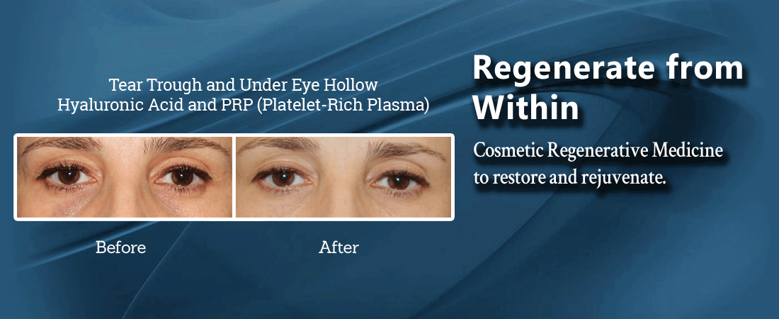 cosmetic regenerative medicine